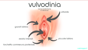 Vulvodinia Milano dott.ssa Cristina Passadore