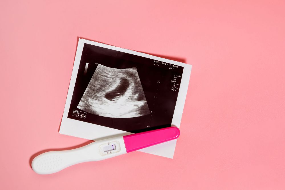 Test di Gravidanza: Quando Farlo per Risultati Affidabili Milano dott.ssa Cristina Passadore