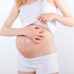 Colestasi Gravidica: Riconoscere il Prurito "Pericoloso" in Gravidanza dott.ssa Cristina Passadore