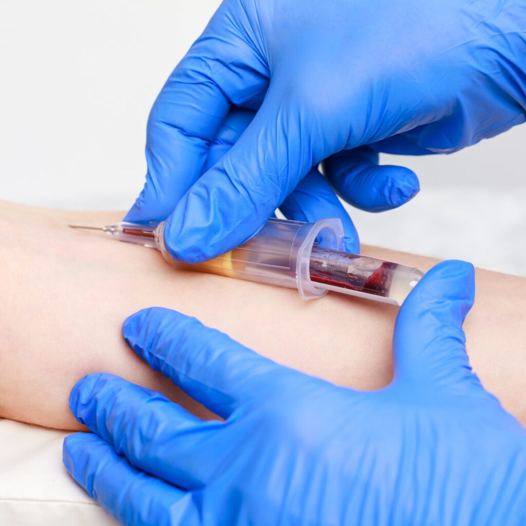 Testosterone per le Donne in Menopausa: Quando è Necessario Integrarlo? Milano dott.ssa Cristina Passadore