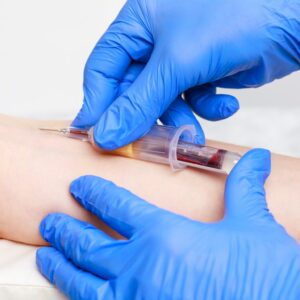Testosterone per le Donne in Menopausa: Quando è Necessario Integrarlo? Milano dott.ssa Cristina Passadore