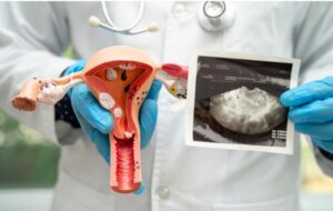 Preparare l'endometrio al concepimento: Integratori e strategie Milano dott.ssa Cristina Passadore