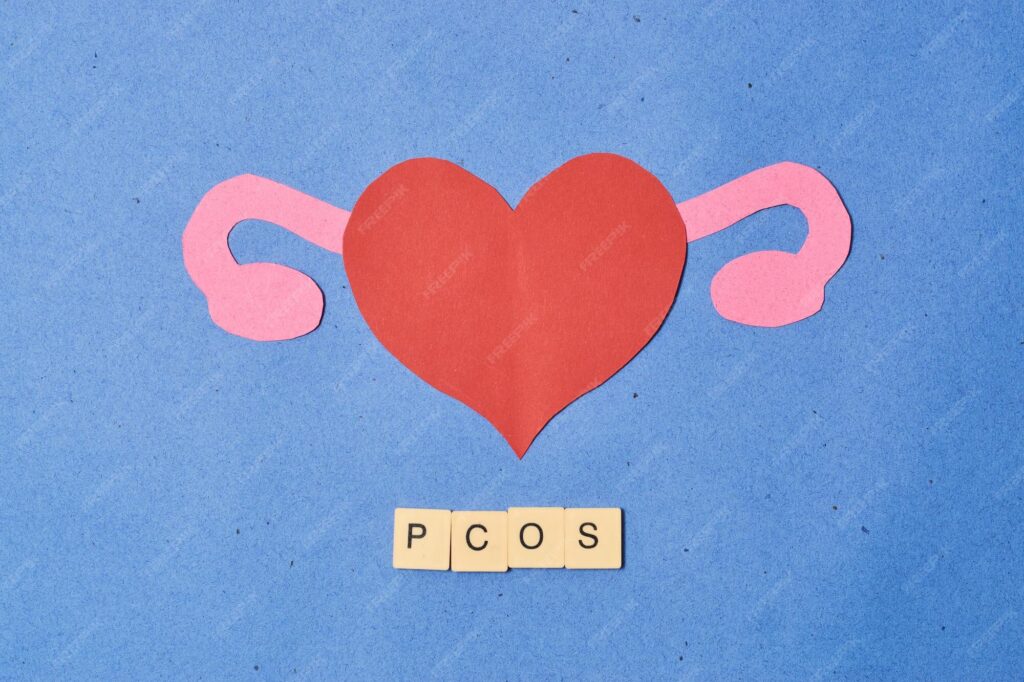 Ovaio Policistico (PCOS): Non Solo Pillola, l’Approccio Metabolico Milano dott.ssa Cristina Passadore
