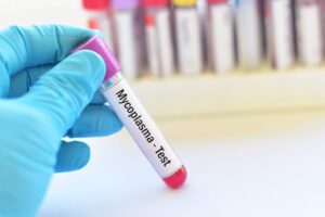 Ureaplasma e Mycoplasma: Vanno Sempre Curati con Antibiotici? Milano dott.ssa Cristina Passadore